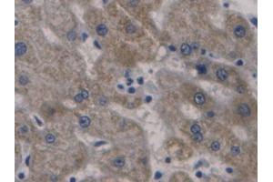Used in DAB staining on fromalin fixed paraffin-embedded Liver tissue (Hepcidin Antikörper  (AA 25-84))