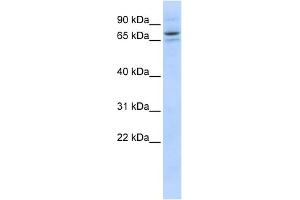 WB Suggested Anti-SEC23B Antibody Titration: 0. (Sec23 Homolog B Antikörper  (Middle Region))