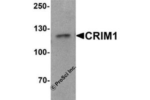 Western Blotting (WB) image for anti-Cysteine Rich Transmembrane BMP Regulator 1 (Chordin-Like) (CRIM1) (C-Term) antibody (ABIN1030343) (CRIM1 Antikörper  (C-Term))