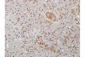 Immunohistochemistry (IHC) image for anti-Wingless-Type MMTV Integration Site Family Member 2 (WNT2) (AA 221-320) antibody (ABIN762896)