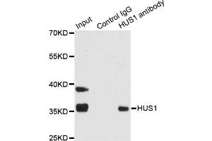 Immunoprecipitation analysis of 200ug extracts of 293T cells using 1ug HUS1 antibody (ABIN1876595). (HUS1 Antikörper)
