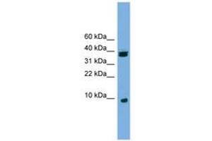 Image no. 1 for anti-Ribosomal Protein S21 (RPS21) (C-Term) antibody (ABIN6745111)
