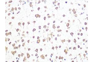 Immunohistochemistry (IHC) image for anti-THO Complex 4 (THOC4) antibody (ABIN1679512)