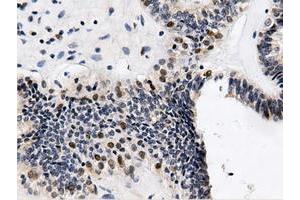 Immunohistochemical staining of paraffin-embedded Human Kidney tissue using anti-QPRT mouse monoclonal antibody. (QPRT Antikörper)