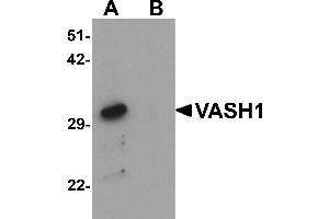 Western blot analysis of VASH1 in human brain tissue lysate with VASH1 antibody at 1 µg/mL in (A) the absence and (B) the presence of blocking peptide. (VASH1 Antikörper  (C-Term))