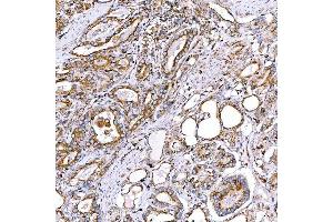 IHC analysis of RAB7/RAB7A using anti-RAB7/RAB7A antibody (ABIN7600597).