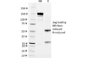 SDS-PAGE (SDS) image for anti-CD3 epsilon (CD3E) antibody (ABIN6941032)