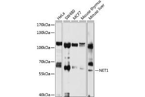 Western blot analysis of extracts of various cell lines, using NET1 antibody (ABIN3021741, ABIN3021742, ABIN1513253 and ABIN6215710) at 1:1000 dilution. (NET1 Antikörper  (AA 1-300))