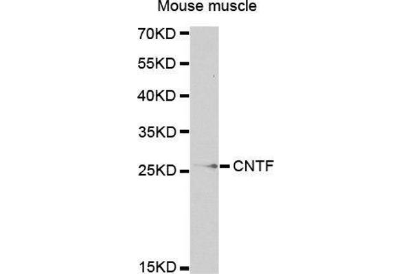 CNTF Antikörper  (AA 1-200)