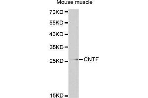 Western Blotting (WB) image for anti-Ciliary Neurotrophic Factor (CNTF) (AA 1-200) antibody (ABIN3015705) (CNTF Antikörper  (AA 1-200))