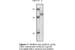 Western Blotting (WB) image for anti-Ribosomal Protein S6 Kinase, 90kDa, Polypeptide 1 (RPS6KA1) (truncated) antibody (ABIN2464100) (RPS6KA1 Antikörper  (truncated))