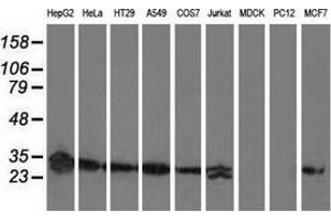 Western blot analysis of extracts (35 µg) from 9 different cell lines by using anti-SPR monoclonal antibody. (SPR Antikörper)