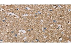 Immunohistochemistry of paraffin-embedded Human brain using PIP4K2A Polyclonal Antibody at dilution of 1:40 (PIP4K2A Antikörper)