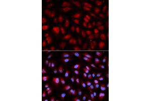 Immunofluorescence analysis of U2OS cell using PLK1 antibody. (PLK1 Antikörper  (AA 304-603))