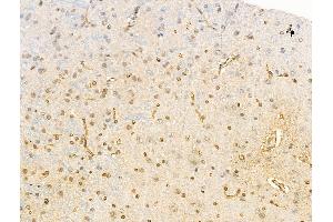ABIN6255261 and ABIN6267114 at 1/100 staining Rat brain tissue by IHC-P. (EEF2K Antikörper  (pSer366))