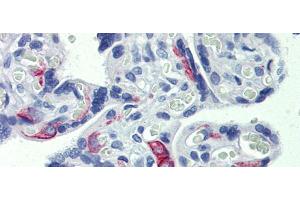 Human placenta; Anti-ZNF71 antibody IHC staining of human placenta. (ZNF71 Antikörper)