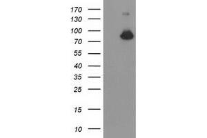Western Blotting (WB) image for anti-Acyl-CoA Synthetase Short-Chain Family Member 2 (ACSS2) antibody (ABIN1496429) (ACSS2 Antikörper)