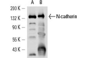 Image no. 1 for anti-Cadherin 2 (CDH2) antibody (ABIN272296) (N-Cadherin Antikörper)