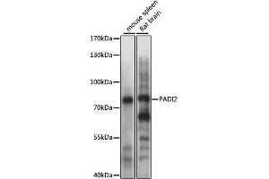Western blot analysis of extracts of various cell lines, using PADI2 antibody (ABIN4904665) at 1:1000 dilution. (PADI2 Antikörper)