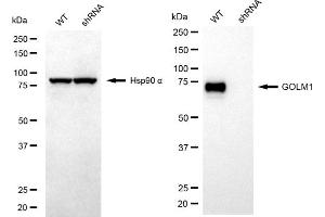 Western blotting analysis using GOLM1 antibody (ABIN7798793).