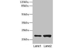 Western blot All lanes: CDC42 antibody at 6 μg/mL Lane 1: Hela whole cell lysate Lane 2: Jurkat whole cell lysate Secondary Goat polyclonal to rabbit IgG at 1/10000 dilution Predicted band size: 22 kDa Observed band size: 22 kDa