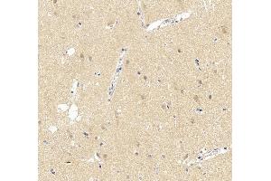 IHC analysis of UBE3A using anti-UBE3A antibody (ABIN7599562). (ube3a Antikörper  (AA 1-860))