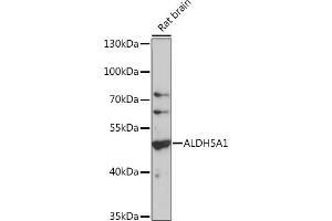 Western blot analysis of extracts of rat brain, using  antibody (6074) at 1:1000 dilution. (ALDH5A1 Antikörper  (AA 400-500))