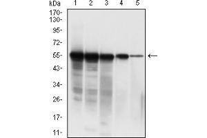 Western blot analysis using SARS-CoV-2-NP3 mAb against human SARS-CoV-2-N (AA: 1-419) recombinant protein. (SARS-CoV-2-NP3 (AA 240-419) Antikörper)
