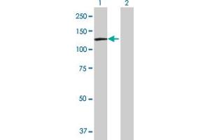 Western Blotting (WB) image for DDX11 293T Cell Transient Overexpression Lysate(Denatured) (ABIN1331562)