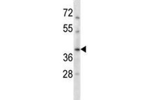 RAD51C antibody western blot analysis in HepG2 lysate. (RAD51C Antikörper  (AA 169-198))
