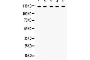 Anti- TRPM8 Picoband antibody, Western blottingAll lanes: Anti TRPM8  at 0. (TRPM8 Antikörper  (C-Term))