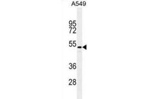 Western Blotting (WB) image for anti-Transforming Growth Factor, beta 2 (TGFB2) antibody (ABIN2995350) (TGFB2 Antikörper)