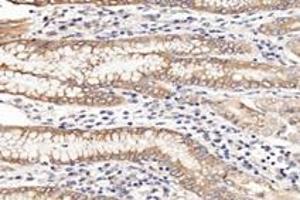 Immunohistochemistry (Paraffin-embedded Sections) (IHC (p)) image for anti-NCK Associated Protein 1 (NCKAP1) antibody (ABIN7074784)