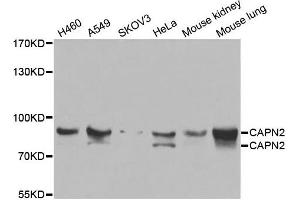 Western blot analysis of extracts of various cell lines, using CAPN2 antibody. (Calpain 2 Antikörper)