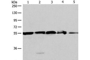 Western Blot analysis of A375, 293T cell and Mouse liver tissue, Jurkat cell and Human fetal kidney tissue using NAMPT Polyclonal Antibody at dilution of 1:700 (NAMPT Antikörper)
