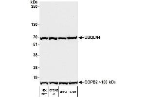 Western Blotting (WB) image for anti-Ubiquilin 4 (UBQLN4) (AA 2-601) antibody (ABIN7453990)