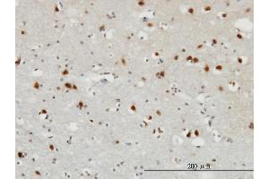 Immunostaining (ISt) image for anti-Fibroblast Growth Factor 12 (FGF12) (AA 1-181) antibody (ABIN560869)