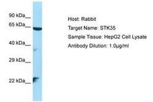 Image no. 1 for anti-Serine/threonine Kinase 35 (STK35) (AA 106-155) antibody (ABIN6750141) (STK35 Antikörper  (AA 106-155))