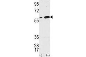 Western blot analysis of VIM antibody and 293 cell lysate (2 ug/lane) either nontransfected (Lane 1) or transiently transfected with the VIM gene (2).