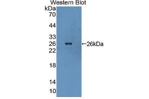 Figure. (BCR Antikörper  (AA 1042-1243))