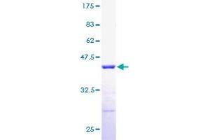 Image no. 1 for Ribosomal Protein, Large, P2 (RPLP2) (AA 1-115) protein (GST tag) (ABIN1318686) (RPLP2 Protein (AA 1-115) (GST tag))