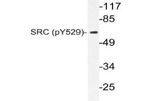 Western blot (WB) analysis of p-c-RAF antibody in extracts from K562 cells. (NCOA1 Antikörper  (pTyr529))