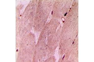 Immunohistochemical analysis of RPL3L staining in human muscle formalin fixed paraffin embedded tissue section. (RPL3L Antikörper  (Center))