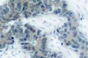 Image no. 1 for anti-Janus Kinase 2 (JAK2) (pTyr1007) antibody (ABIN318056) (JAK2 Antikörper  (pTyr1007))