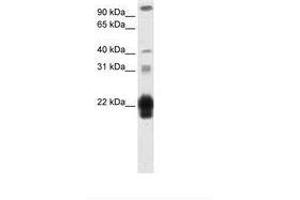 Image no. 2 for anti-Chorionic Somatomammotropin Hormone 1 (Placental Lactogen) (CSH1) (AA 121-170) antibody (ABIN203034)
