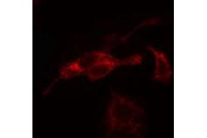 ABIN6266835 staining Hela cells by IF/ICC. (ADPGK Antikörper  (Internal Region))