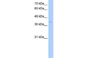WB Suggested Anti-ZDHHC17 Antibody Titration:  5. (ZDHHC17 Antikörper  (Middle Region))