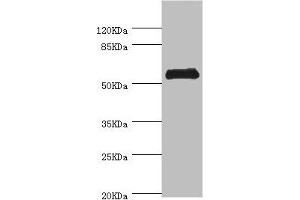 Western blot All lanes: CHIA antibody at 0. (CHIA Antikörper  (AA 1-368))