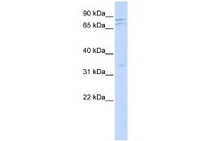 NEK11 antibody used at 1 ug/ml to detect target protein. (NEK11 Antikörper)
