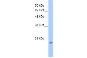 Western Blot showing DNTTIP1 antibody used at a concentration of 1-2 ug/ml to detect its target protein. (DNTTIP1 Antikörper  (N-Term))